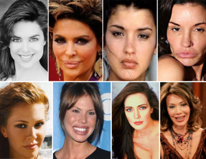 HUNTER TYLO, PLASTIC SURGERY, PLASTISCHE CHIRURGIE,