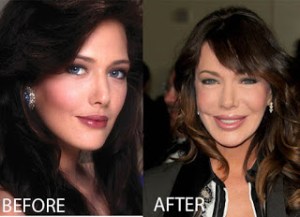 HUNTER TYLO, PLASTIC SURGERY, PLASTISCHE CHIRURGIE,