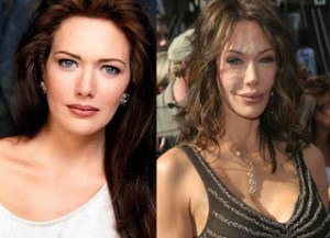 HUNTER TYLO, PLASTIC SURGERY, PLASTISCHE CHIRURGIE,