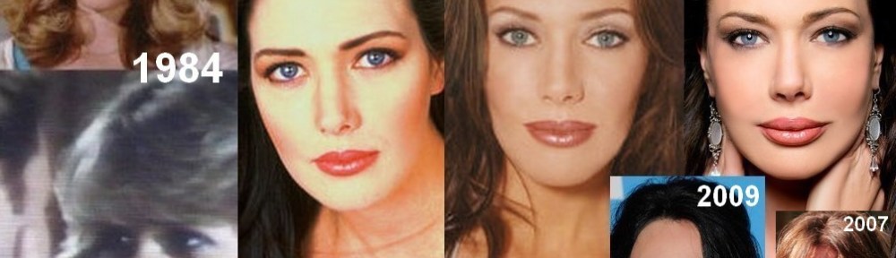 HUNTER TYLO, PLASTIC SURGERY, PLASTISCHE CHIRURGIE,