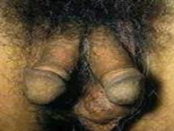 man-with-2-penis-NaijaExclusive.net_.jpg-6